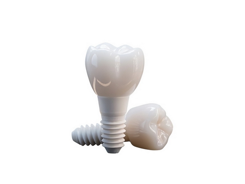 Zubní implantát – biokeramika